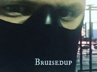 Bruisedup