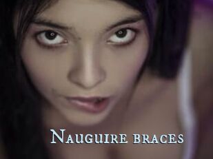 Nauguire_braces
